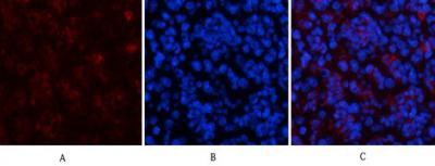 HP1-γ Mouse Monoclonal Antibody2F5