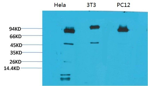 STAT3 Monoclonal Antibody1E3