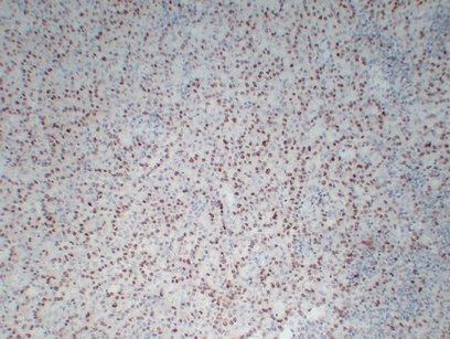 WT1 Mouse Monoclonal AntibodyPT0264