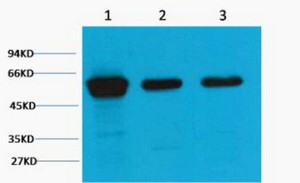 Vimentin Monoclonal Antibody1A7