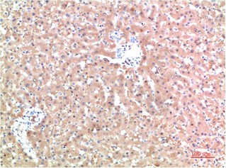 TTR Mouse Monoclonal Antibody10D8