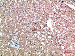 TTR Mouse Monoclonal Antibody3B5