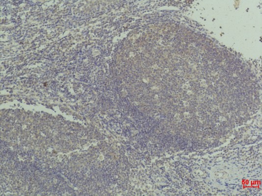 TNF α Monoclonal AntibodyQ36