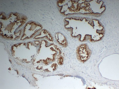 PSMA 2A2 mouse Monoclonal Antibody