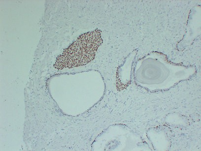 p63 1C2 mouse Monoclonal Antibody