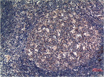 MLKL Mouse Monoclonal Antibody8H7