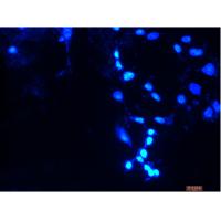 AGS 人胃腺癌细胞