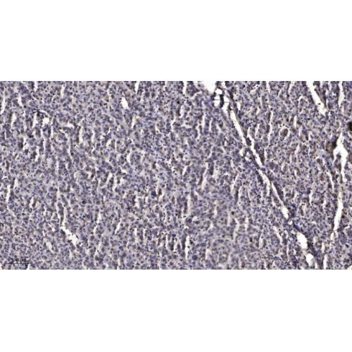 INPP5J Polyclonal Antibody