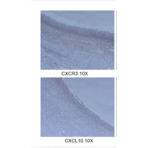 IP-10 Polyclonal Antibody