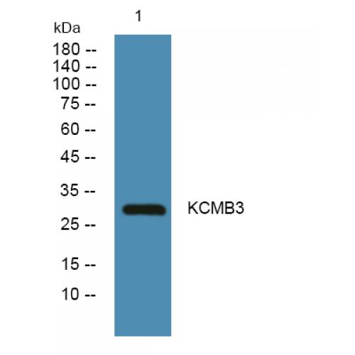 KCMB3 Polyclonal Antibody