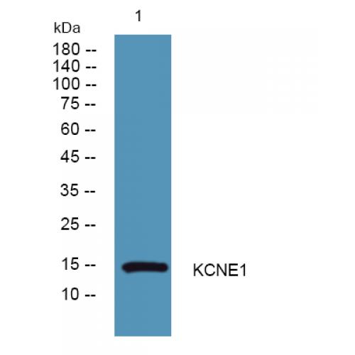 KCNE1 Polyclonal Antibody