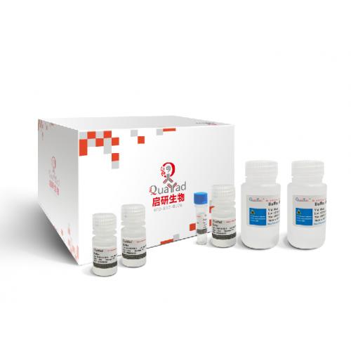 通用型总RNA提取试剂盒 Universal Total RNA Kit