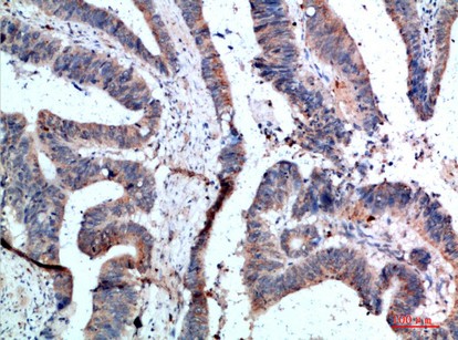 APRIL Polyclonal Antibody