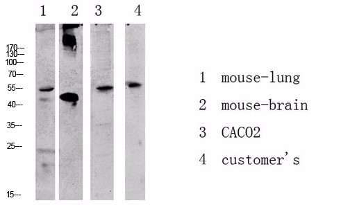 Akt antibody