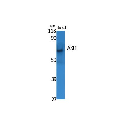 Akt1 Polyclonal Antibody