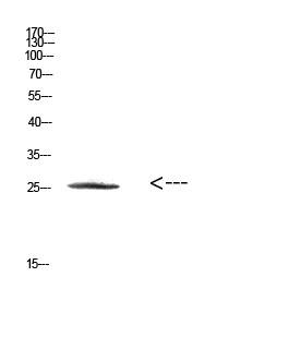 HSP27 Polyclonal Antibody