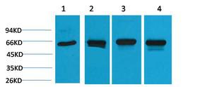 HSP60 Polyclonal Antibody