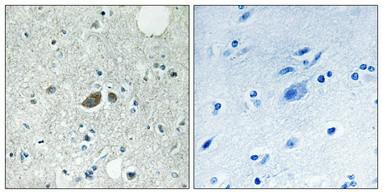 HSP60 Polyclonal Antibody