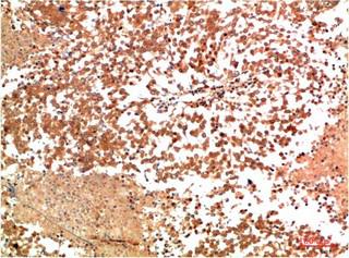 HSP90-α Rabbit Polyclonal Antibody