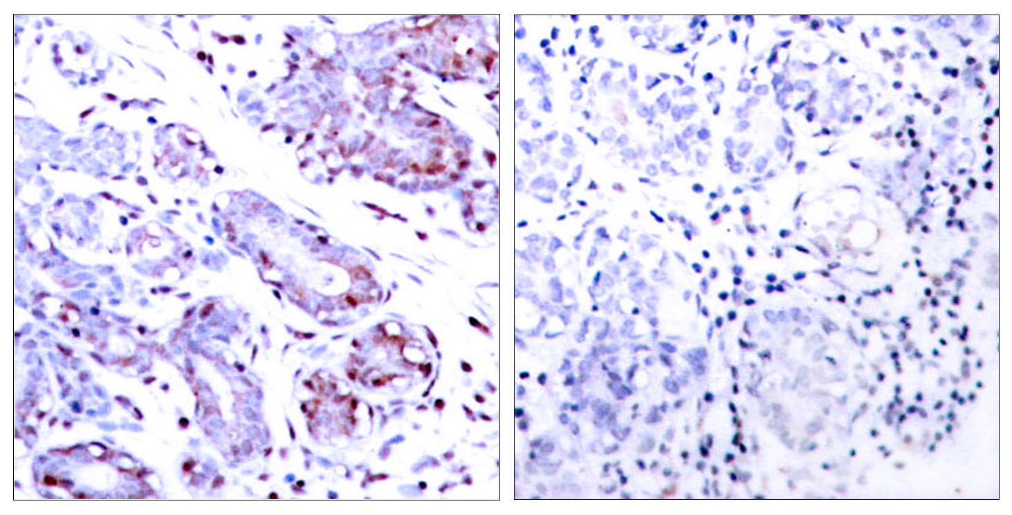 Stat1 Polyclonal Antibody