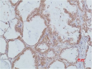 Stat2 Polyclonal Antibody