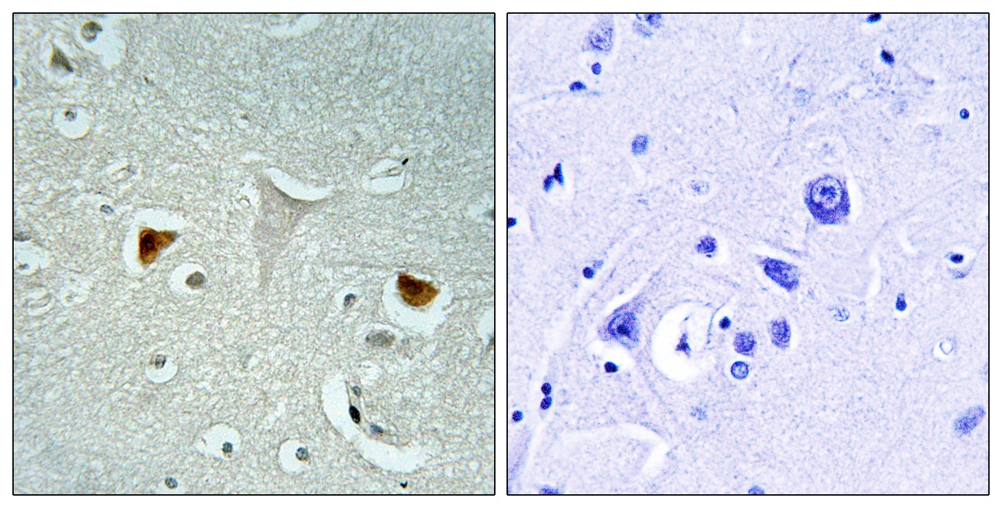 Stat3 Polyclonal Antibody