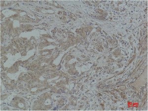 Stat3 Polyclonal Antibody