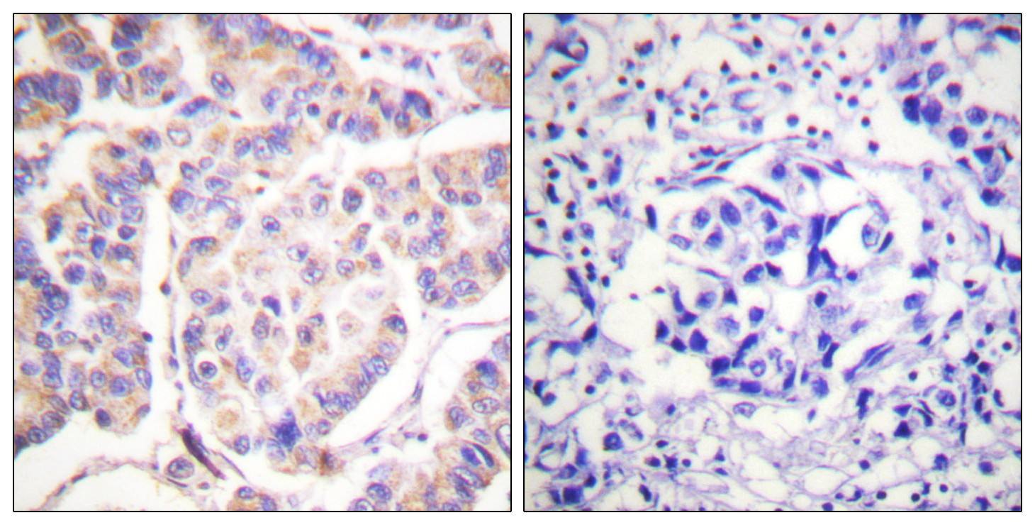 Syk Polyclonal Antibody