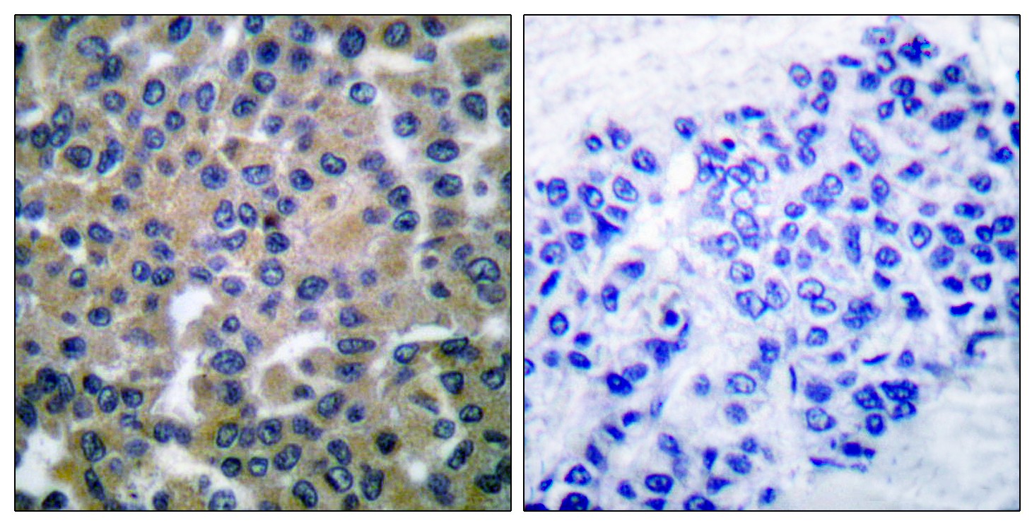 Syk Polyclonal Antibody