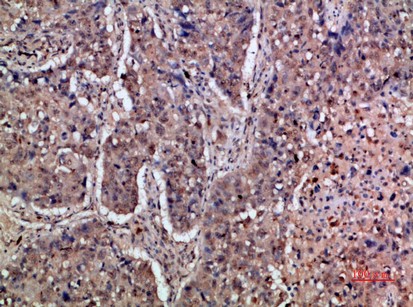 IFN-α/βRα Polyclonal Antibody