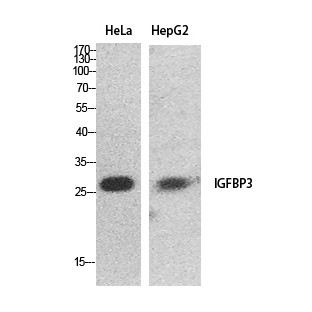 IGFBP3 Polyclonal Antibody