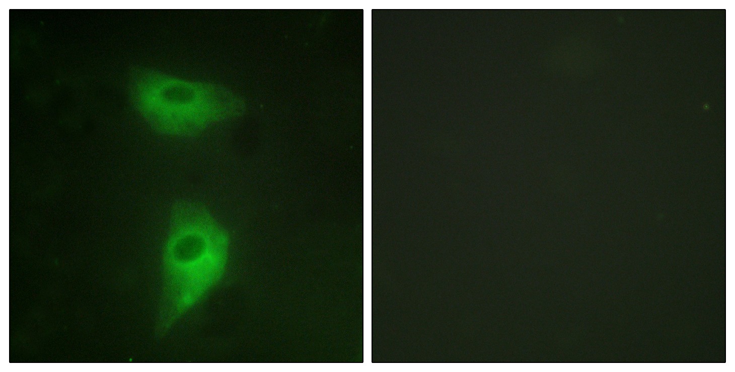 IGF-IIR Polyclonal Antibody