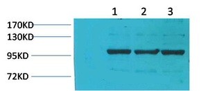 IGFN1 Polyclonal Antibody