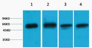 Akt3 Polyclonal Antibody