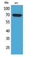 Amphiphysin II Polyclonal Antibody