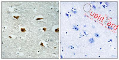 4E-BP1 Polyclonal Antibody