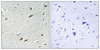 FoxO1 Polyclonal Antibody