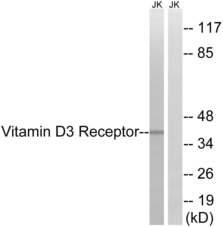 VDR Polyclonal Antibody