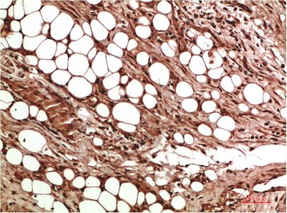 VEGF Rabbit Polyclonal Antibody