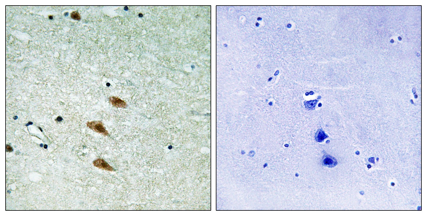 Topo IIα Polyclonal Antibody