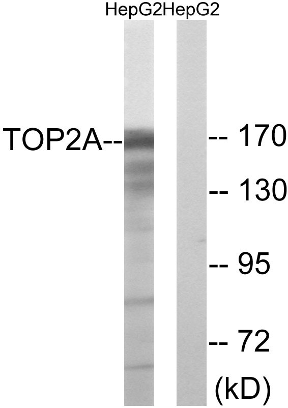 Topo IIα Polyclonal Antibody