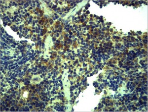 TLR1 Polyclonal Antibody