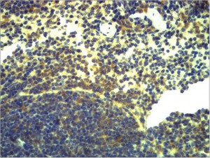 TLR2 Polyclonal Antibody