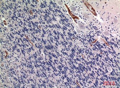 TNAP Polyclonal Antibody