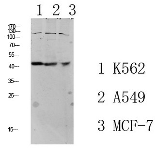 TGF β1 Polyclonal Antibody