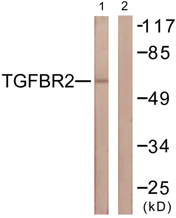 TGFβ RII Polyclonal Antibody