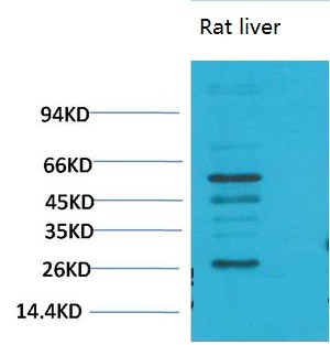 TGFβ1 Polyclonal Antibody