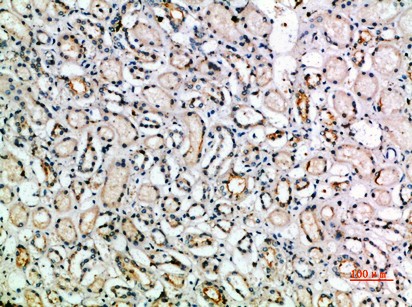 TGFβ3 Polyclonal Antibody