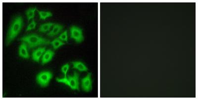 Frizzled-4 Polyclonal Antibody