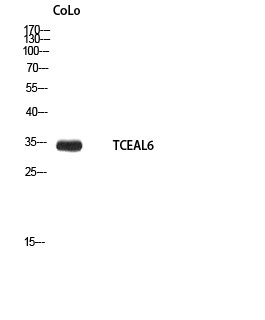 TCEAL6 Polyclonal Antibody